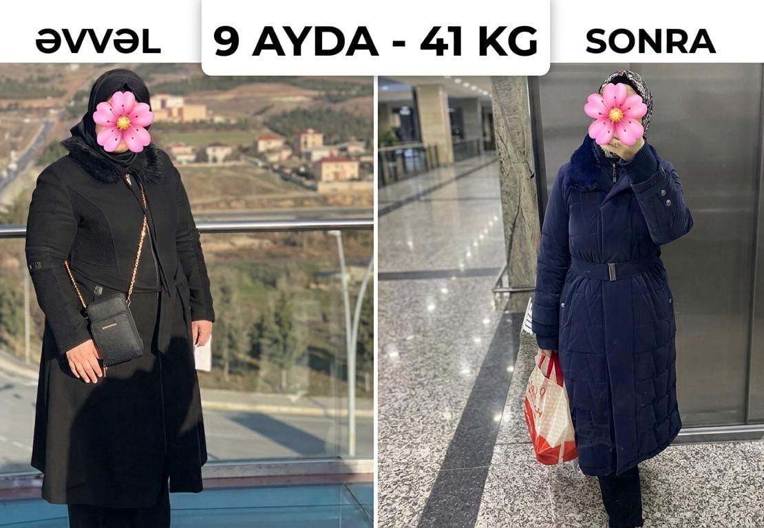 Bədən analizi