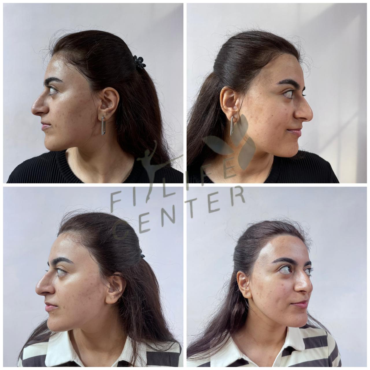 Üz baxım seansı