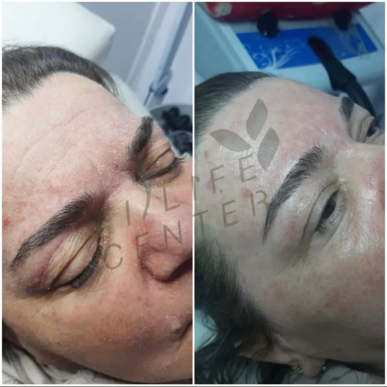Üz baxım seansı